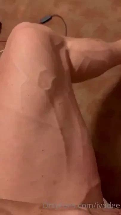 I could not decide which one is better so i upload both veins veins 