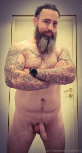 Notice the black eye haha had a fight with an electric kickbike and