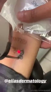 This shit hurt like a bitch they numb and u still feel the pain so i