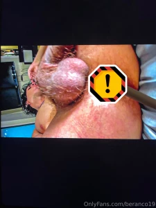 Butthole exposed part 2 for rimmers a subs