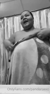 How to do show the doctor my eczema lmao