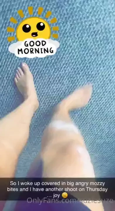 Afternoon guys well i have woken up to 8 angry mozzy bites all on my 