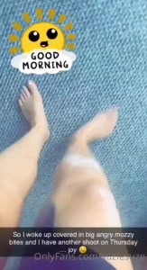 Afternoon guys well i have woken up to 8 angry mozzy bites all on my