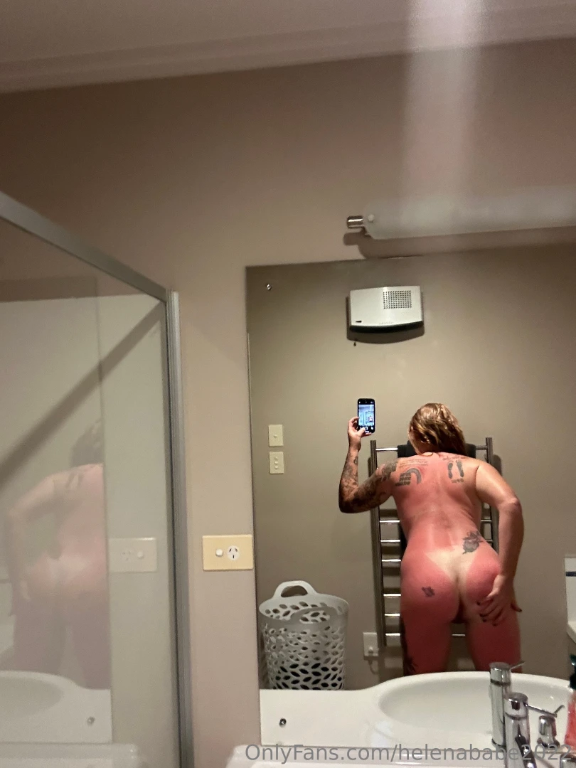 This is so painful reminder to wear sunscreen 