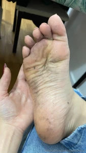 Sole appreciation post part 3