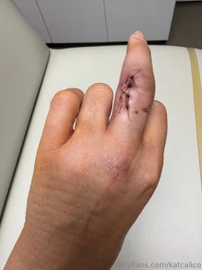 4 stiches and an arrow