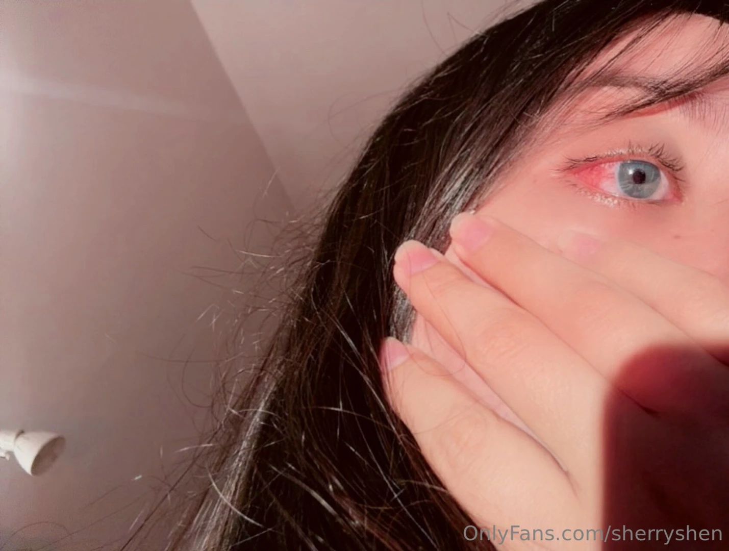 Something got into my eye and it s very irritated right now it s 