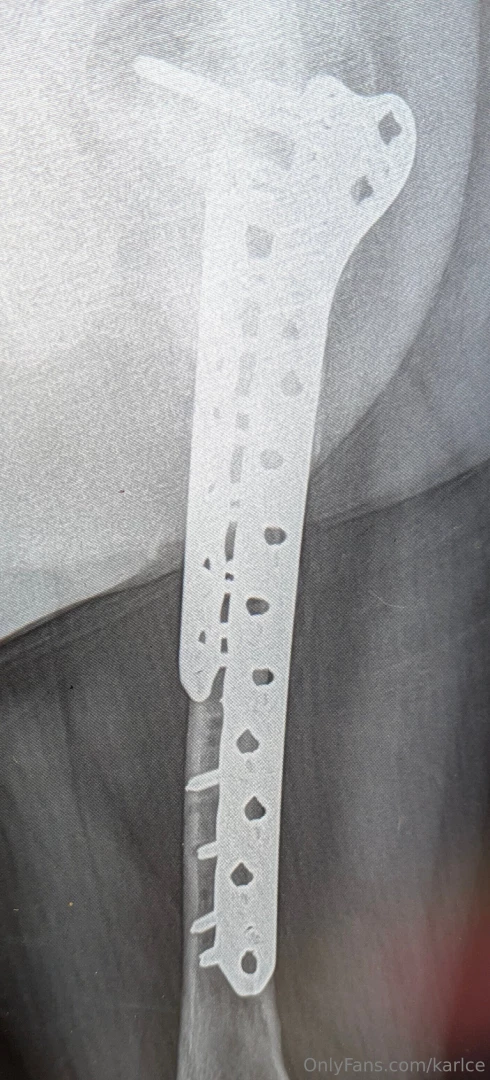 Latest set of hardware for those interested part 1 