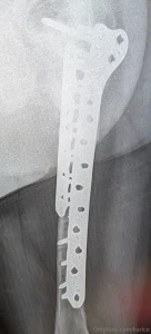 Latest set of hardware for those interested part 1