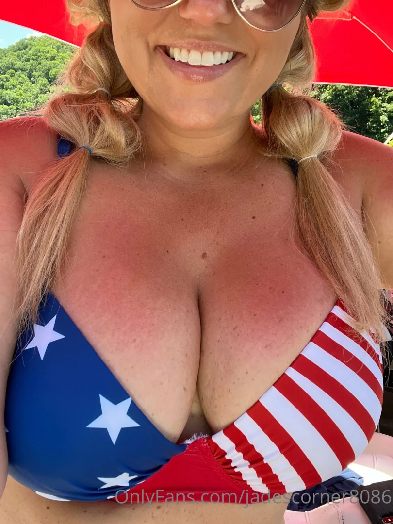 I m burnt to a crisp today who s going to rub aloe vera all over my 