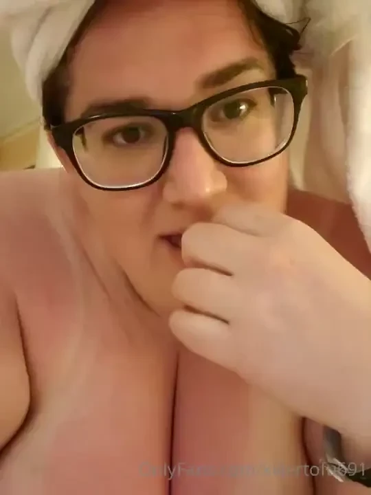 Sun burned and covered in bug bites would you drill me anyways 