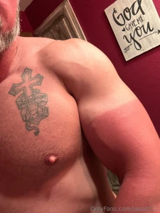 A little sun burn on the golf course today