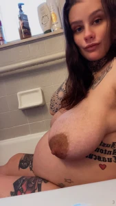 Surgery s in 11 days guys drop some love for recovery