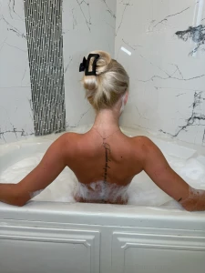 Back rubs are welcomed