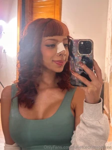 Post op update i m healing really nicely and i hope i can get back to part 2