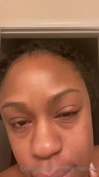 Sorry i haven t been as active this week guys a bih had a sty in her 