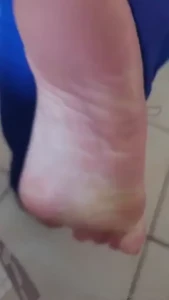 Look how my feet gets smelly when i use my crocks