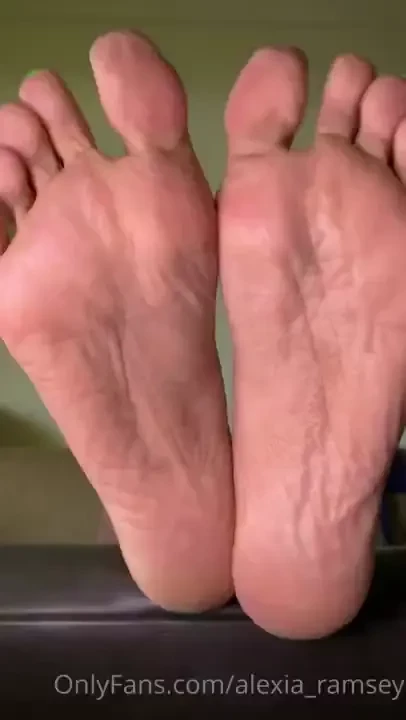 My poor soles all dry and weathered from the sun and beach sorry been 