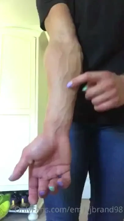 Veins come out to play 