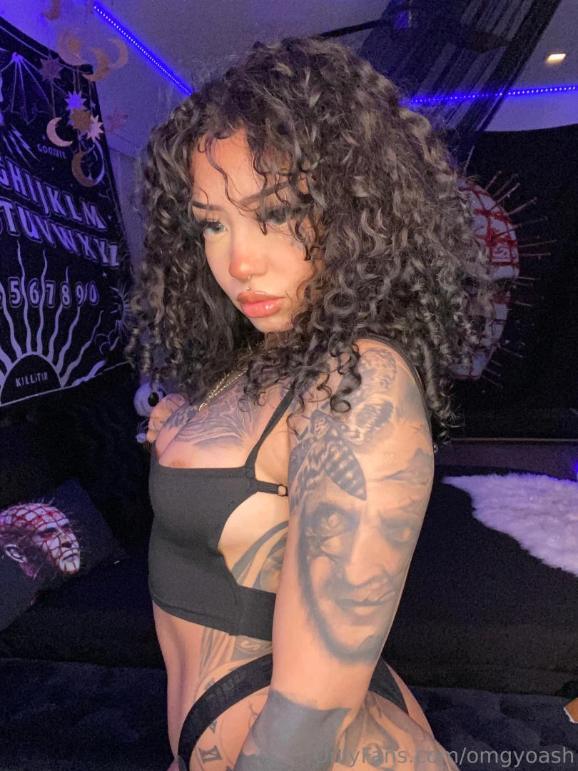 I get my stitches out tomorrow part 1 