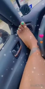 Finally got my feet done after 5 months