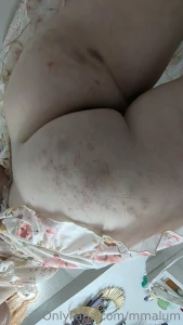 Don t i mark and bruise so pretty