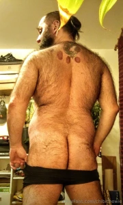 My back looks like a slice of pizza d