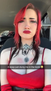 Boobee s i got stung on my boob today