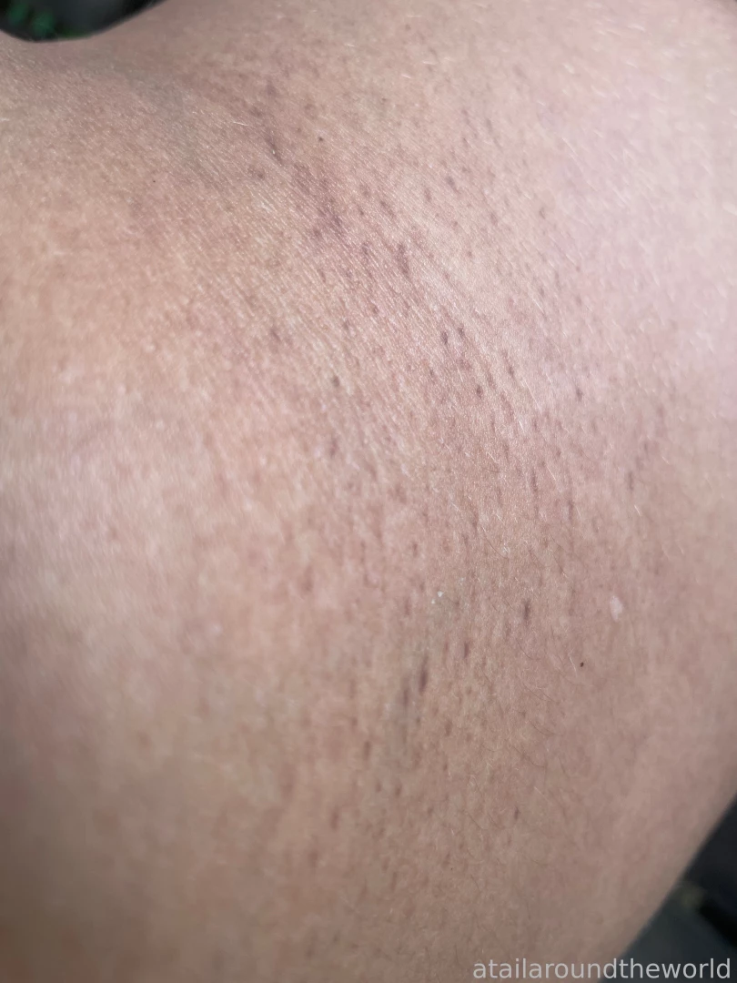 25 - n09 - skin texture perfection doesn t exist the closer you look part 2 