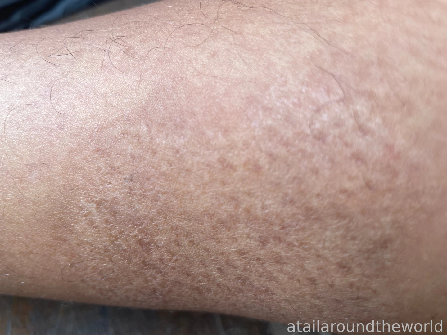 25 - n09 - skin texture perfection doesn t exist the closer you look part 9 