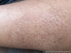 25 - n09 - skin texture perfection doesn t exist the closer you look part 9