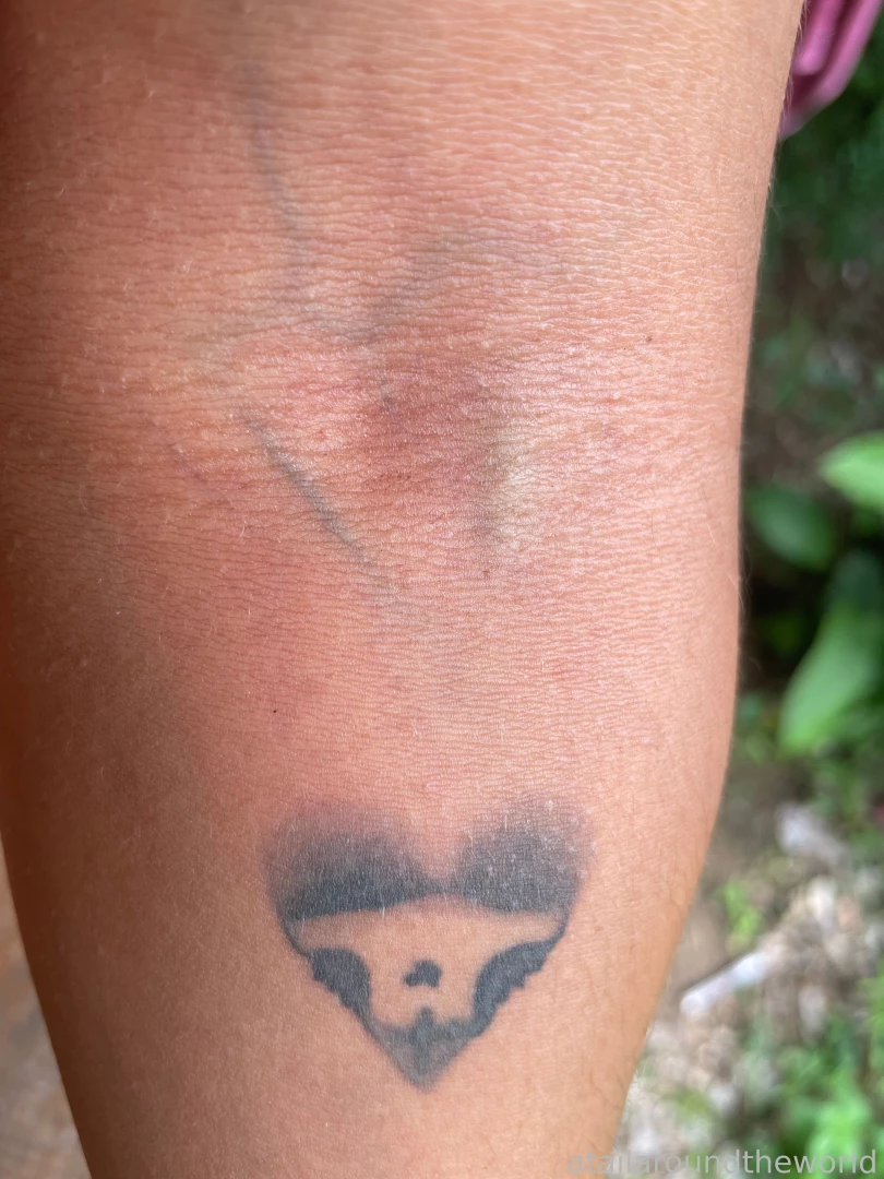 25 - n09 - skin texture perfection doesn t exist the closer you look part 8 