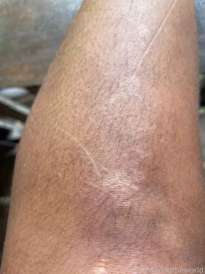 25 - n09 - skin texture perfection doesn t exist the closer you look part 7 