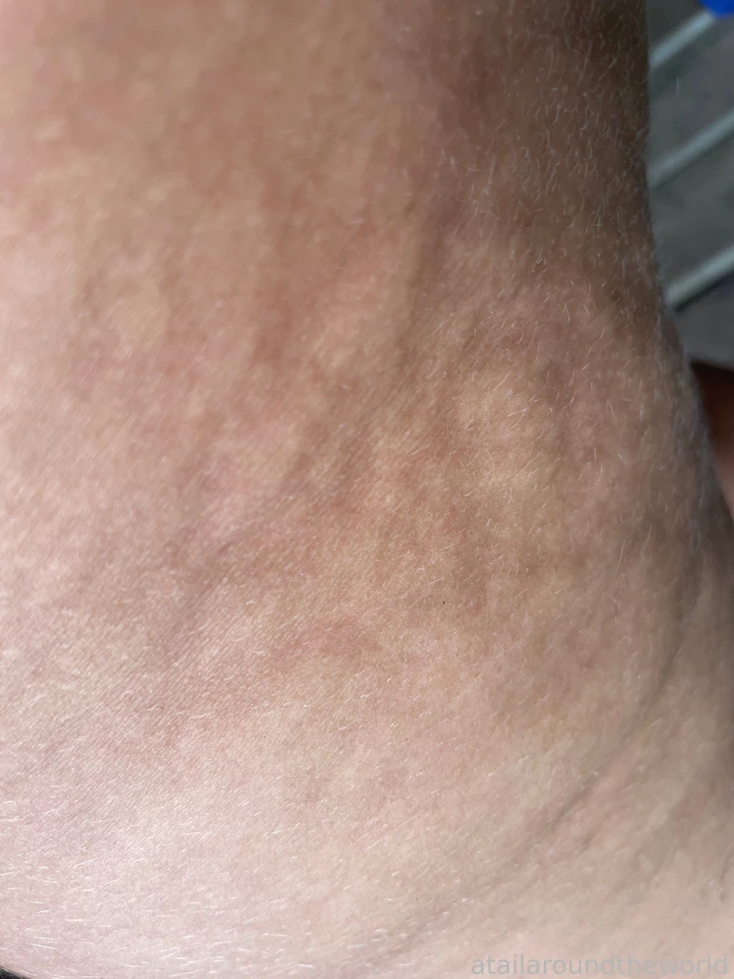 25 - n09 - skin texture perfection doesn t exist the closer you look part 5 