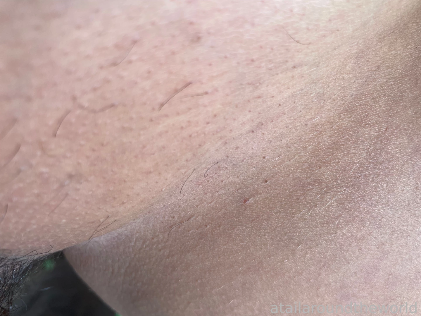 25 - n09 - skin texture perfection doesn t exist the closer you look part 1 