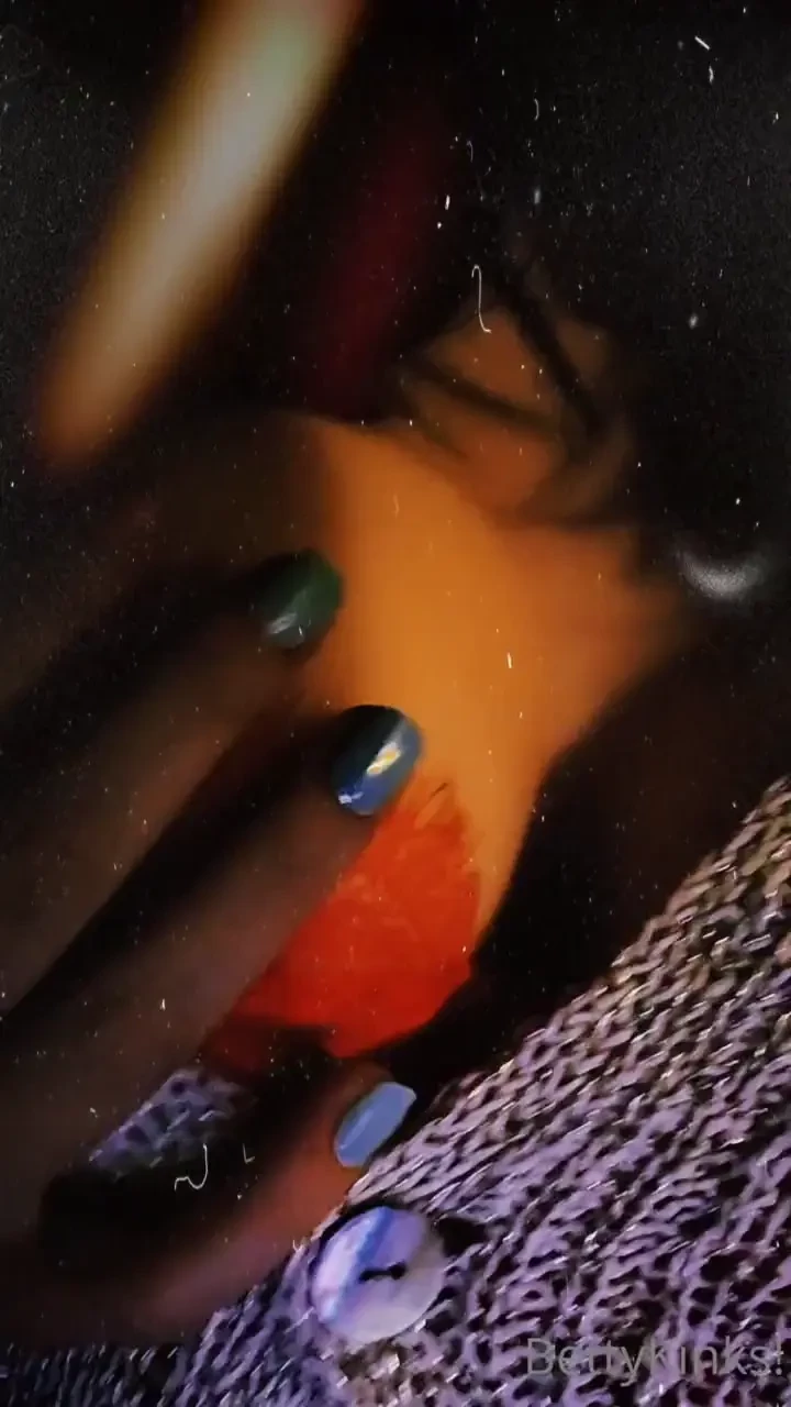 Just a lil sneak preview of how my surgery is looking like love to 