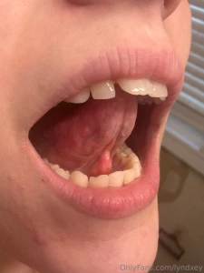 If you look close enough you can see where i split the tissue under my