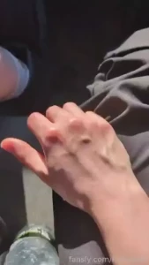 My hands look like this as soon as it gets hot and sometimes i find it