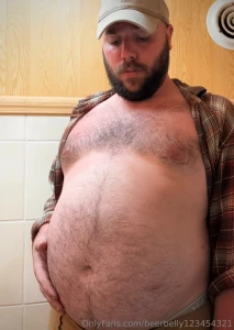 Bugbit and sunburnt at this job but my belly is swelling part 1