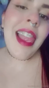 Do you like braces part 1