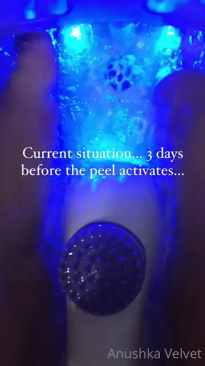 If anyone is interesting in the footage of the peeling process and 