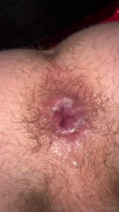 Beat up and filled up hole