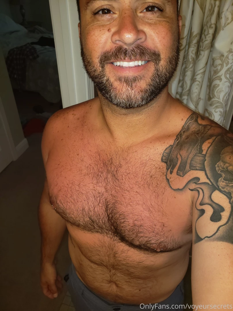 Got a little sunburned at the beach yesterday 