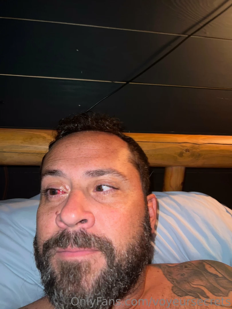 Might be gruesome but it was a quick eye surgery 