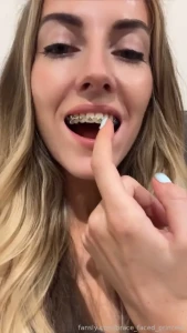 Braces asmr kinda i need a better microphone for this braces