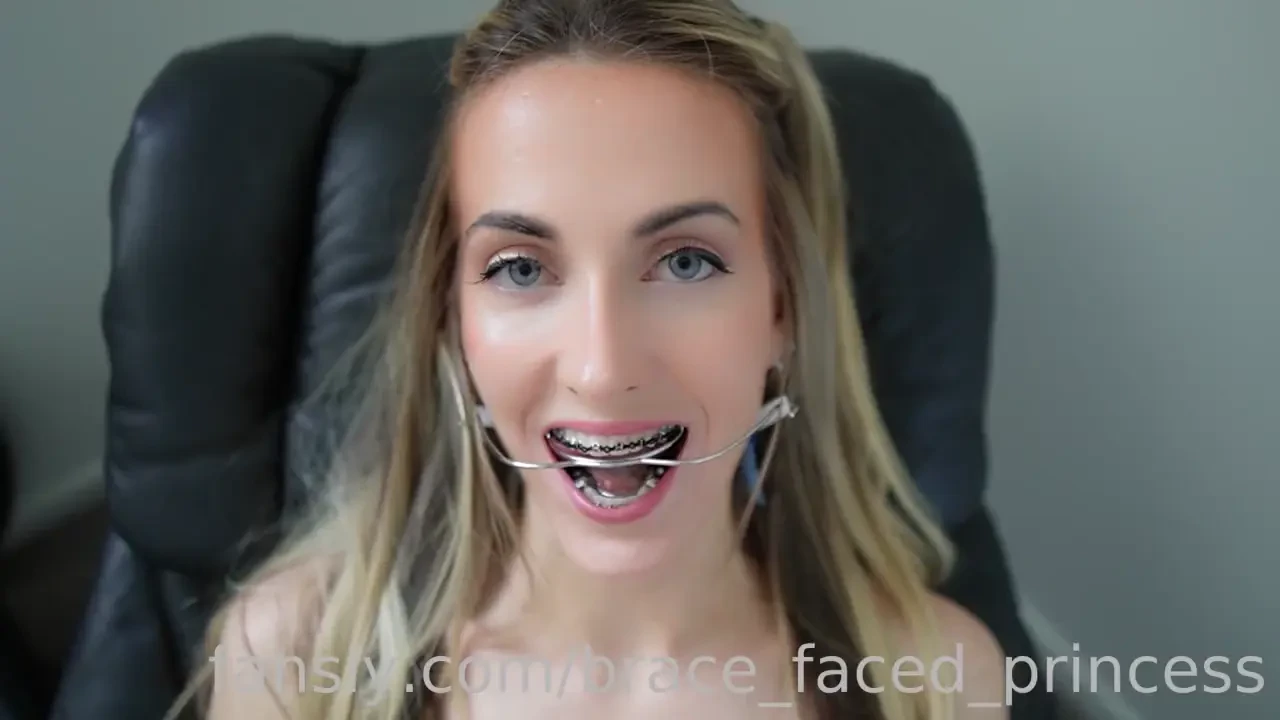 My ortho was satisfied that i could still suck and gag on a cock with 