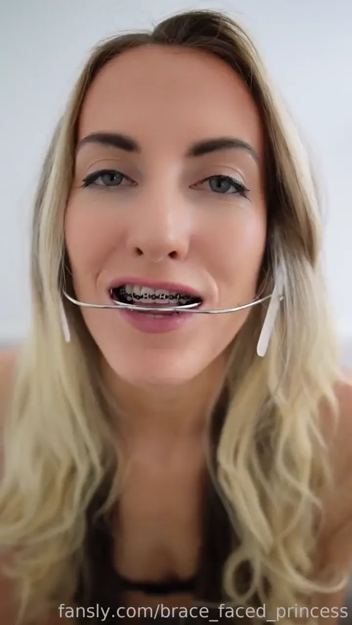 Oops i almost forgot to send out this sexy little braces q amp a mouth 