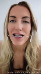 Oops i almost forgot to send out this sexy little braces q amp a mouth