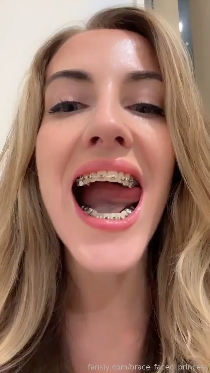 Tehe subscribe to see my whole face and lots of other braces content 