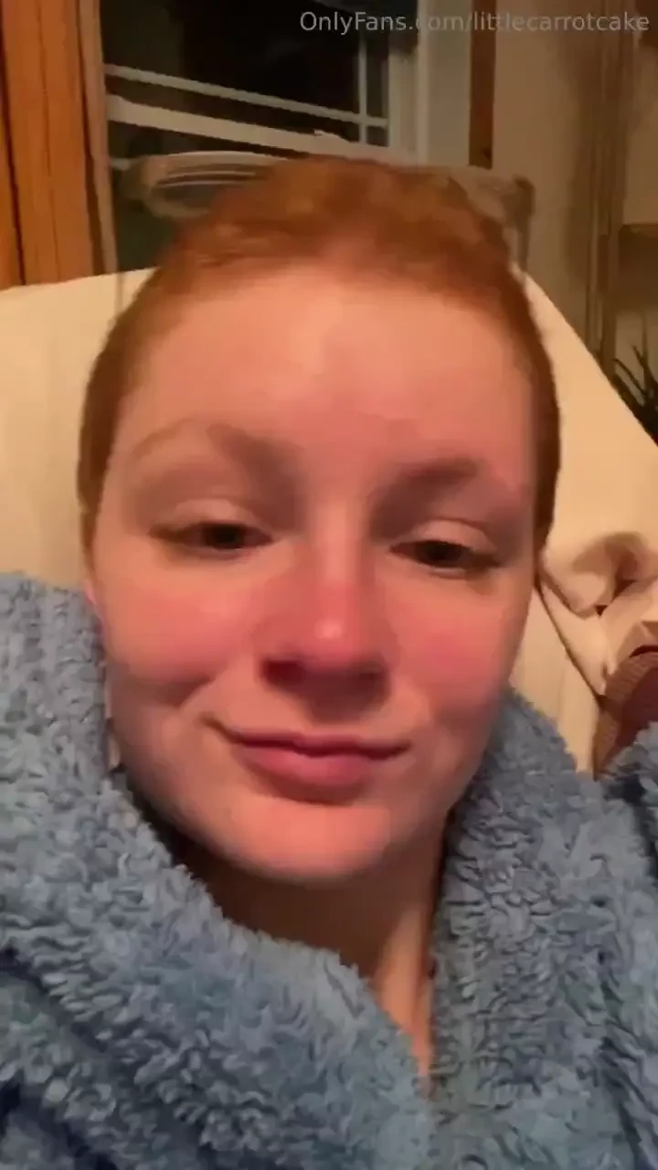Showing you guys my struggles i suffer from trichotillomania as you 